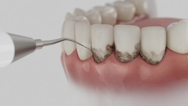 Reliable Dental contractor in Patterson Tract, CA by Smile Center Dentistry